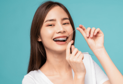 Chỉnh nha mắc cài: 3 sự thật bạn cần biết để có hàm răng hoàn hảo