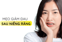 Bảng giá niềng răng mắc cài tại quận Tân Phú