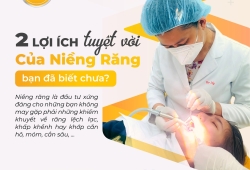 Lợi ích tuyệt vời của niềng răng bạn đã biết chưa?
