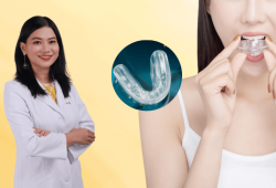 Hàm tùy chỉnh niềng răng trainer tại nhà có hiệu quả như lời đồn?
