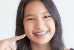 Niềng răng cho trẻ 10 tuổi ở đâu hiệu quả?