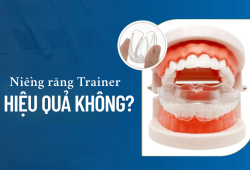Niềng răng trainer có hiệu quả như mong đợi không?