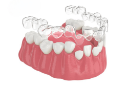 Niềng răng Invisalign - Niềng răng trong suốt giá rẻ tại Cát Tiên Dental