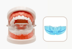 Niềng silicon là gì? Có gây biến chứng gì hay không?