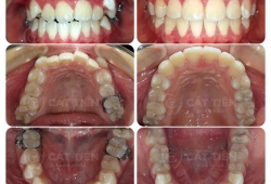  Bác sĩ niềng răng chuyên sâu