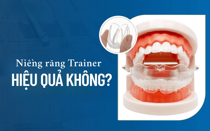 Niềng răng Trainer