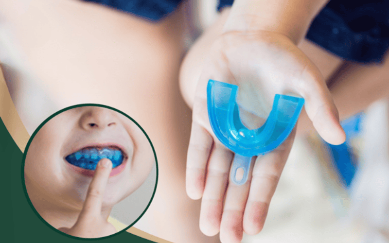 Đối tượng phù hợp với niềng răng trainer