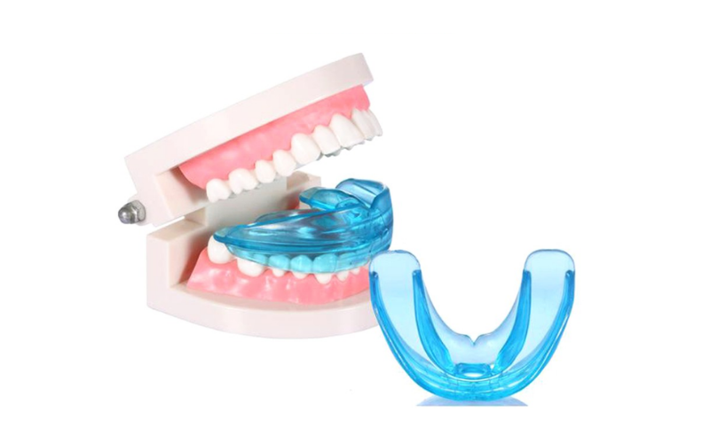 Niềng răng trainer