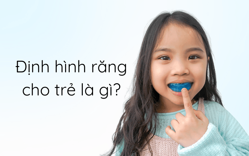 Định hình răng cho trẻ là gì?